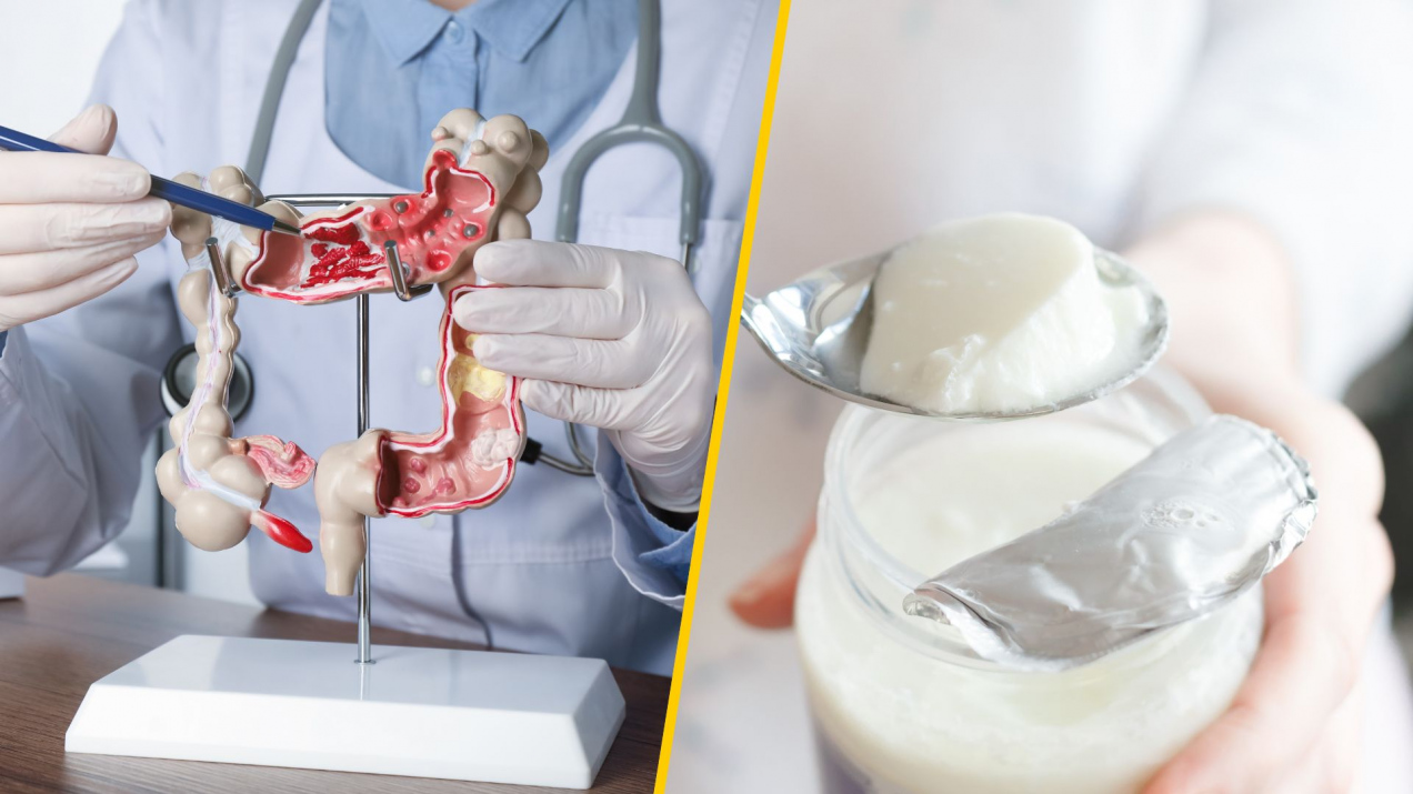 Czy jogurt wpływa pozytywnie na rak jelita grubego? Odkrycia naukowców