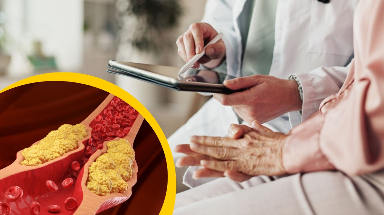 Kardiolog: to najlepszy sposób, by stwierdzić, czy masz za wysoki cholesterol