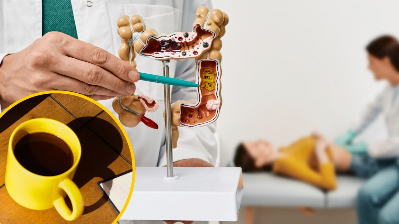 Wiele osób uważa, iż kawa pita rano na pusty żołądek dodaje energii. Mało kto wie, co robi z poziomem cukru